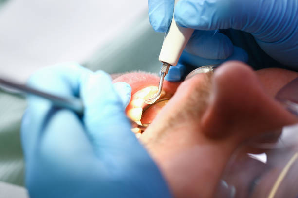 Best Emergency Denture Repair in Hoboken, NJ