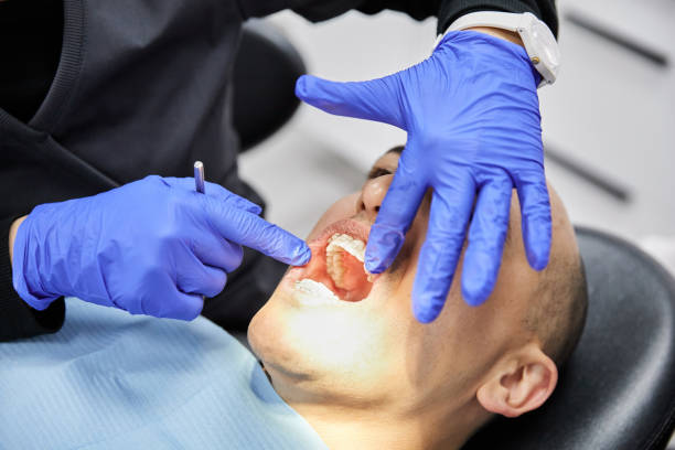 Best Emergency Wisdom Teeth Removal in Hoboken, NJ